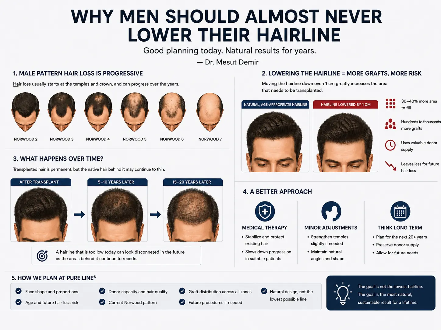 Infographic explaining why men should almost never lower their hairline: Norwood 2–7 progression, the extra grafts required to lower a hairline by 1cm, how it can look disconnected years later, and how Dr. Mesut Demir plans conservative hairline design at Pure Line