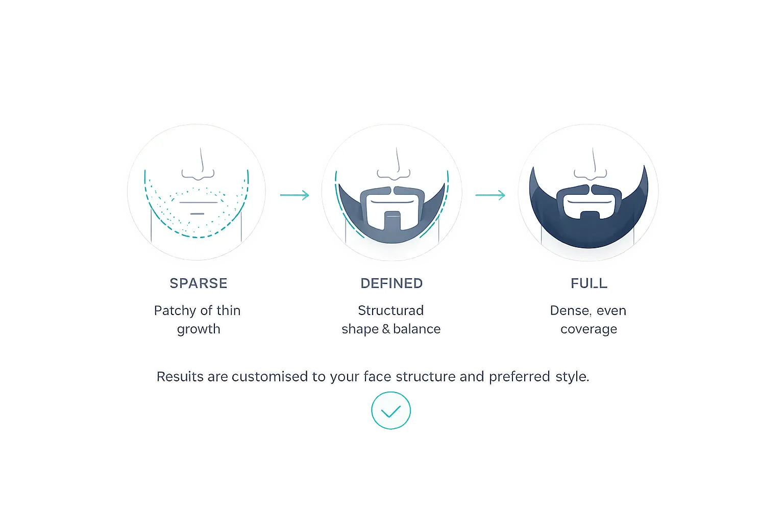 Beard transplantation design — Pure Line Clinic