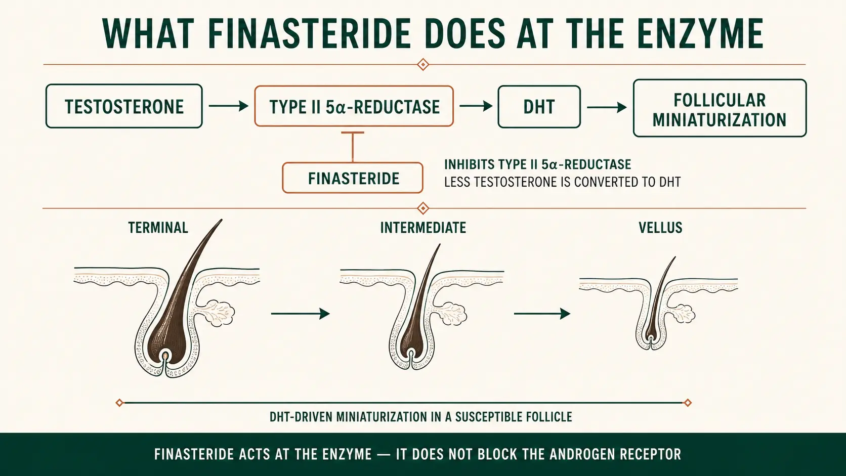 Diagram of how finasteride works: testosterone is converted by type II 5-alpha-reductase into DHT, which drives follicular miniaturization, with finasteride inhibiting that enzyme so less testosterone becomes DHT, shown alongside a follicle thinning from terminal to intermediate to vellus hair
