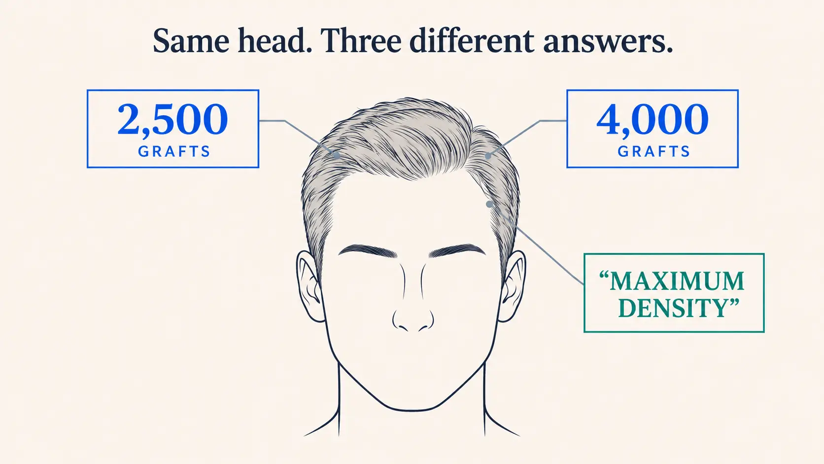 One head drawn from the front with three different hair transplant graft quotes tagged around it - 2,500 grafts, 4,000 grafts, and a third promising maximum density - each connected by a leader line to the same unmarked scalp, under the line: same head, three different answers