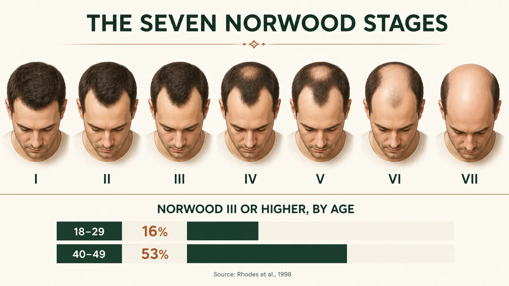 The seven Norwood stages of male pattern hair loss shown in sequence from Type I to Type VII, with the proportion of men reaching Norwood III or higher by age group beneath: 16% at ages 18 to 29 and 53% at ages 40 to 49, from Rhodes 1998