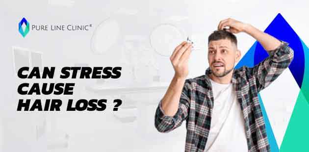 Can Stress Cause Hair Loss ?