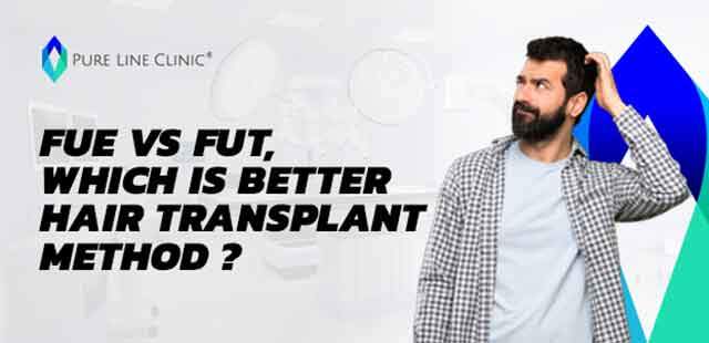 FUE vs FUT, Which is Better Hair Transplant Method ?