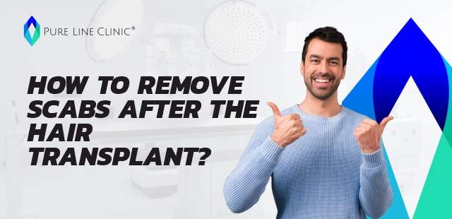 How to Remove Scabs After the Hair Transplant?