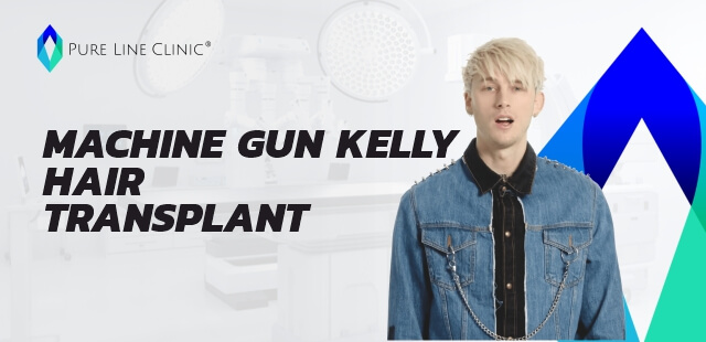Machine Gun Kelly Hair Transplant