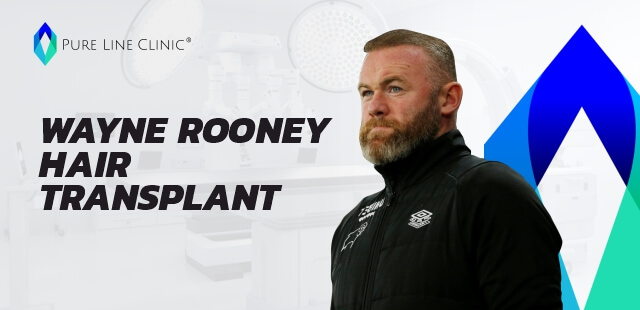 Wayne Rooney Hair Transplant 