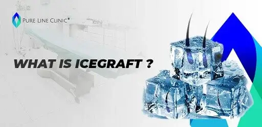 What is Icegraft Method ? 