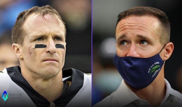 Drew Brees Hair Transplant Before and After